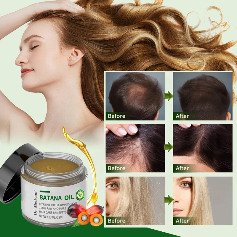 100% Natural Organic Batana Oil Cream For Hair Growth Treatment Hair Loss Alopecia Areata