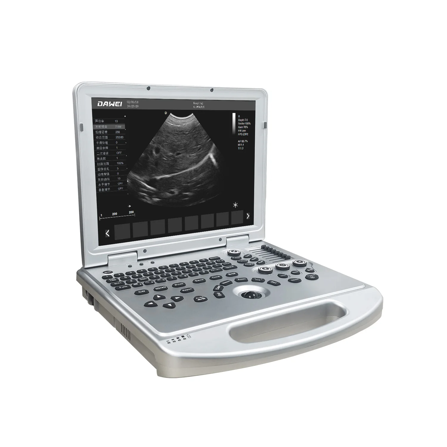 Dawei VCA Ultrasound Specialist Cost Portable Vet Ultrasound Machine for Animal