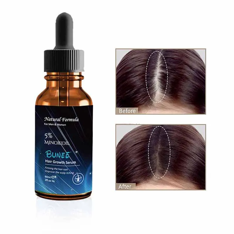 
Hair Scalp Roots Fast Minoxidi 5 Hair Growth Treatment 
