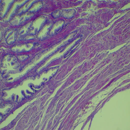 Teaching Microscope Human Pathology Slides (100pcs)