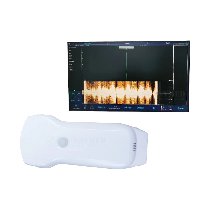SY-A053CL 3 in 1 Pocket Ultrasound Probe Palm Portable Linear/Convex/Phased Array Ultrasound Wireless color doppler Ultrasound