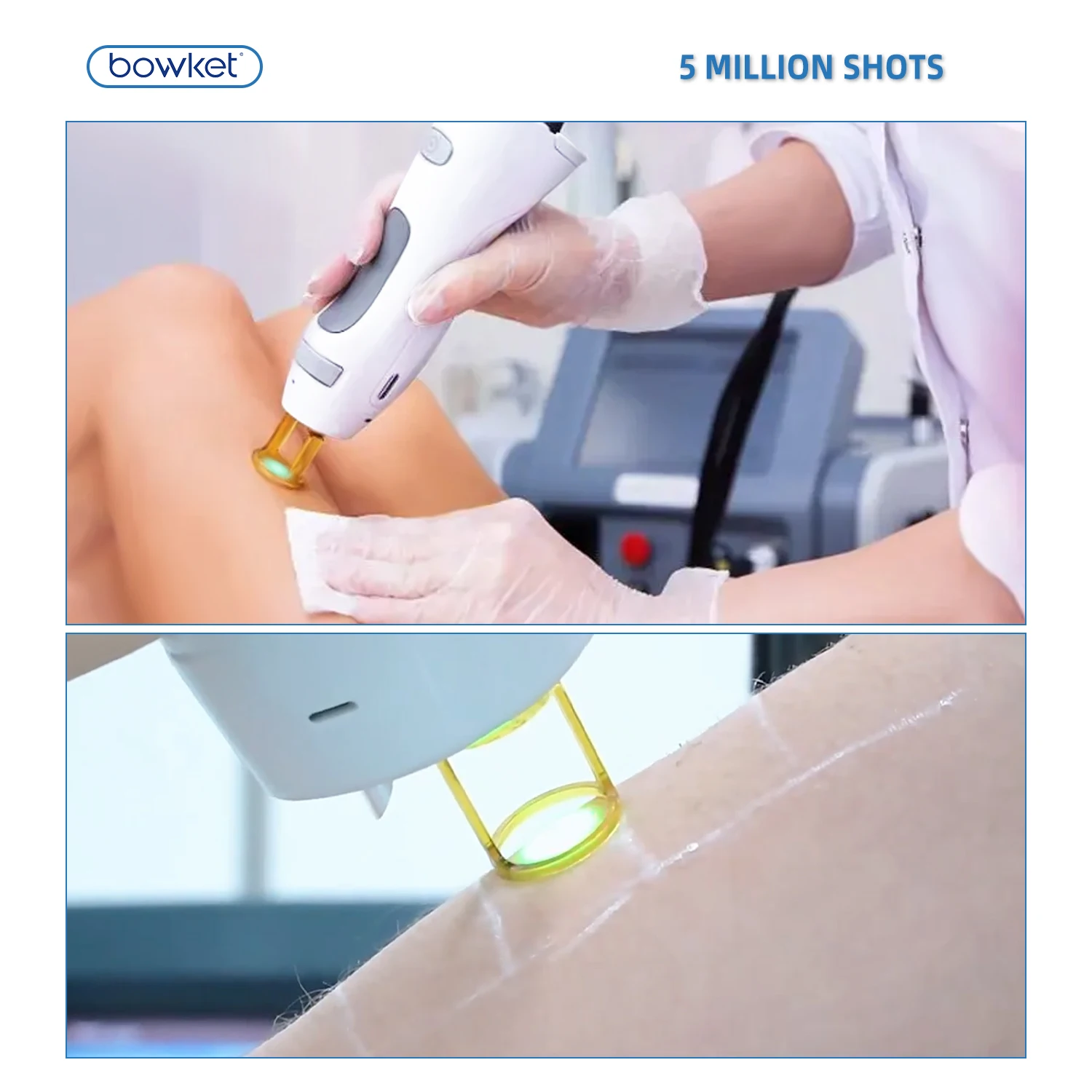 Bowket 2024 1064 ND yag laser  hair removal machine women