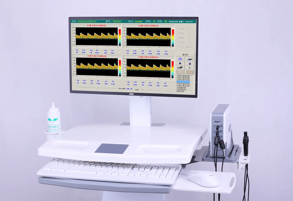 3 Channel Trolley 2Mhz 4Mhz Probe Cervical Vascular Brain Monitor Work Station Intracranial TCD Ultrasound Transcranial Doppler