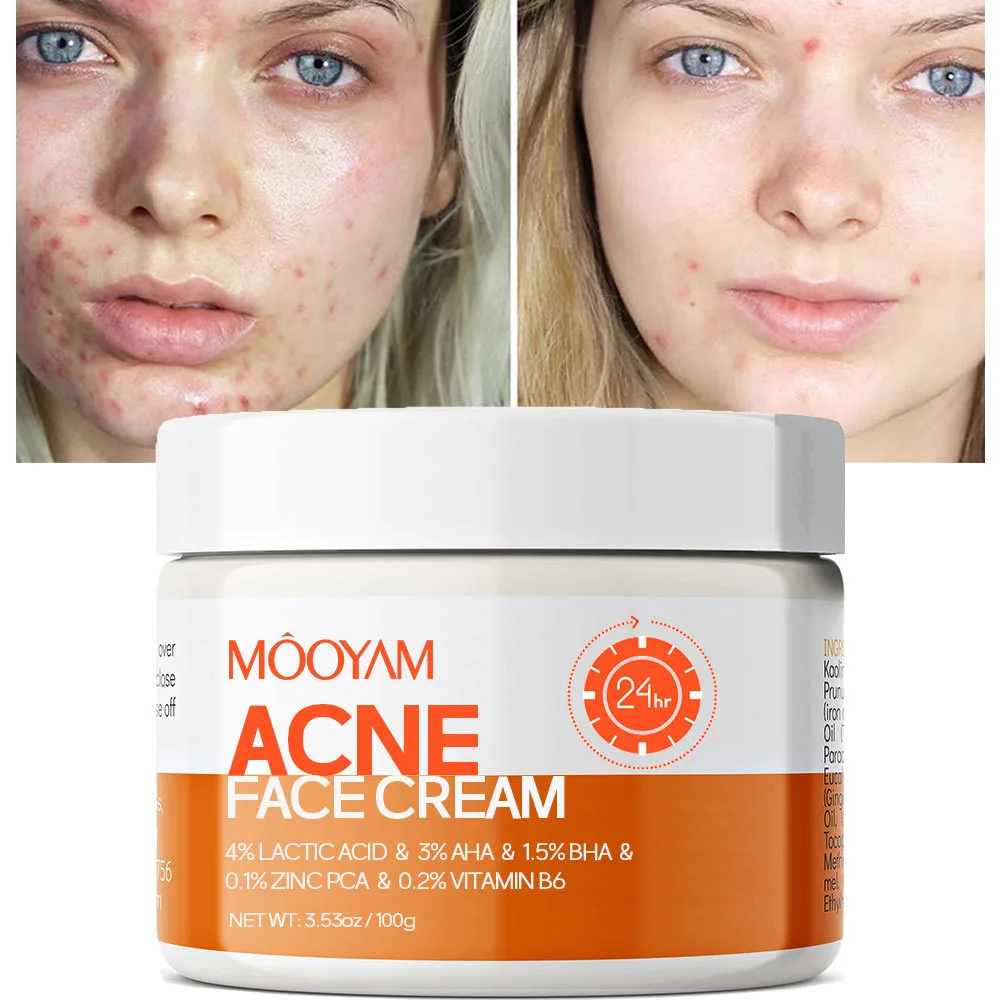 Hot Sale Spot Healing Natural Face Cream Lotion Spot Marks Shrinks Pores Removal Facial Skin Care Cream