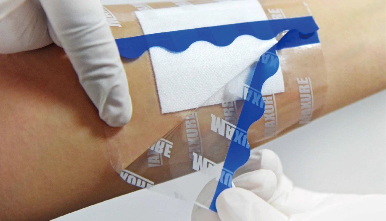 Adhesive Transparent Island Dressing for Wound Care