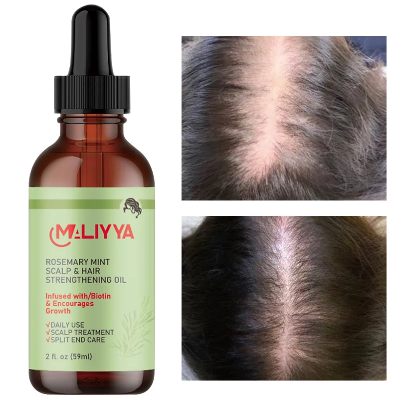 Wholesale private label rosemary hair essence 59ML natural organic nourishment promote hair growth OEM hair essence