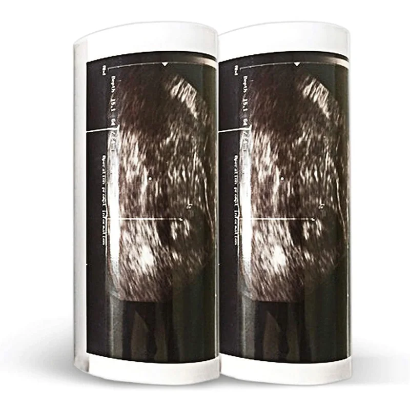 Factory Supply High Gloss Medical 110mm X 18m 110mmx20m UPP 110HG UPP 110S Printing ECG Ultrasound Paper