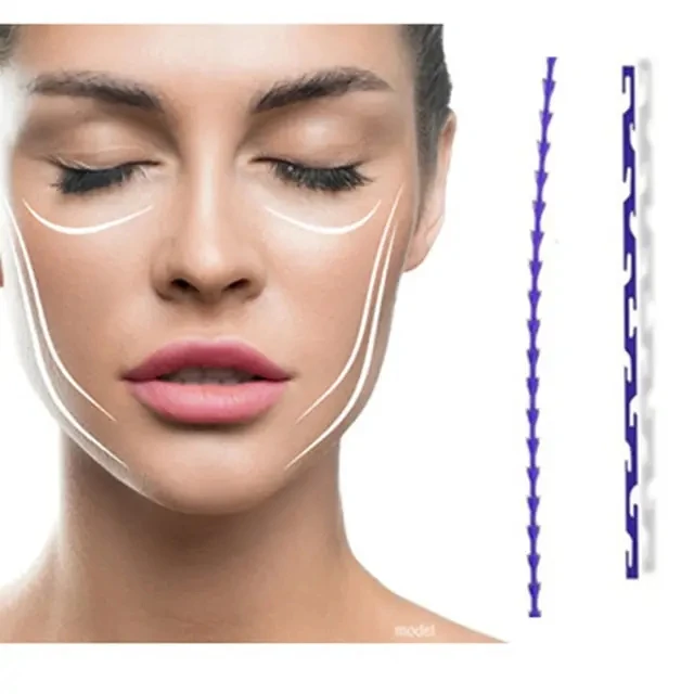 Thread Pdo Fishbone Collagen Face Lifting Thread Hilos Tensores 18g Plla Pcl Pdo Fishbone Thread