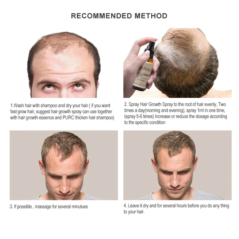 OEM New Hair Growth Spray Fast Grow Hair loss Treatment For Thinning Hair Care 30ml