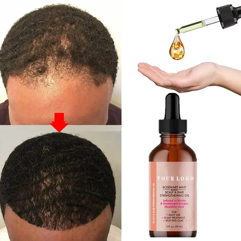 Factory Sale Anti Loss Regrowth Treatment Scalp Massage 100% Pure Natural Biotin Rosemary Mint Fast Effective Hair Growth Oil