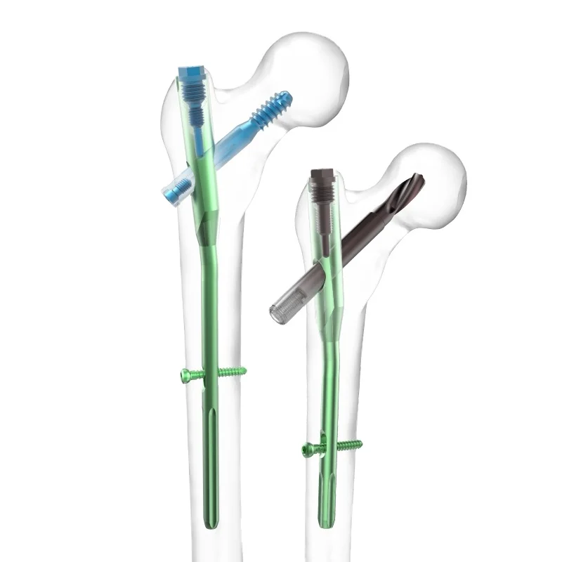 Competitive Price Orthopedic Surgical Implants PFN-IV Intramedually Nail Intertan Nail Orthopedic Interlock Nail