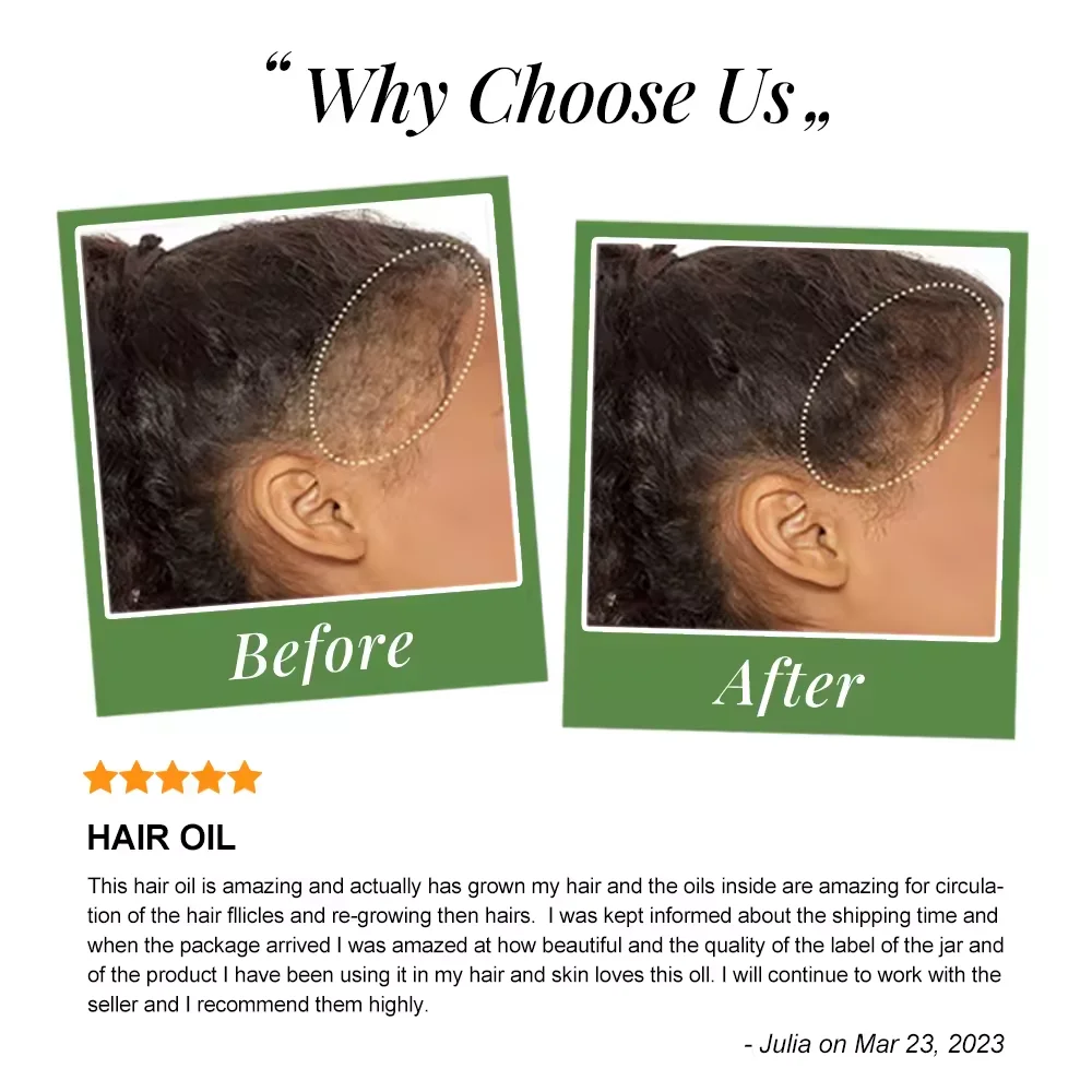 Factory Price Private Label Rosemary And Avocado Hair Growth Oil Serum Natural Fast Hair Growing Castor Oils for Hair Growth