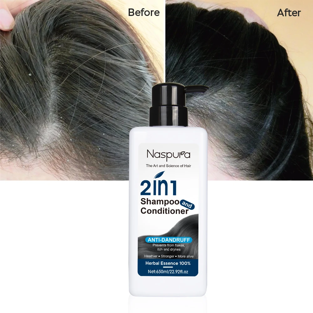 Anti dandruff natural deep cleans long hair herbal  shampoo keratin conditioner 2 in 1 shampoo and conditioner