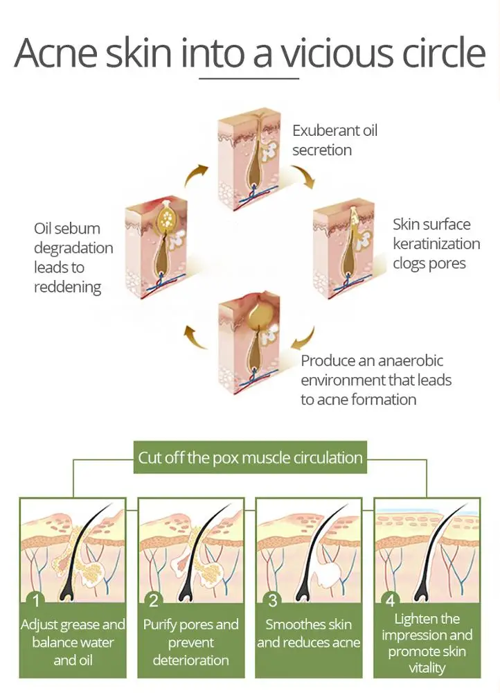 VIBRANT GLAMOUR Tea Tree Anti-Acne Face Cream Oil Control Shrink Pores Acne Cream Nourish Whitening Acne Scar Remove Skin Care