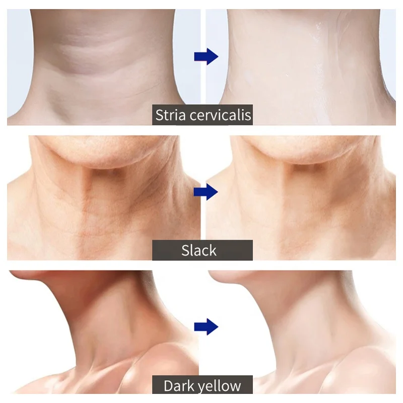 
Cosmetic manufacturer neck massage cream and can stay at home to use lifting repairing and firming skin private label skin care 