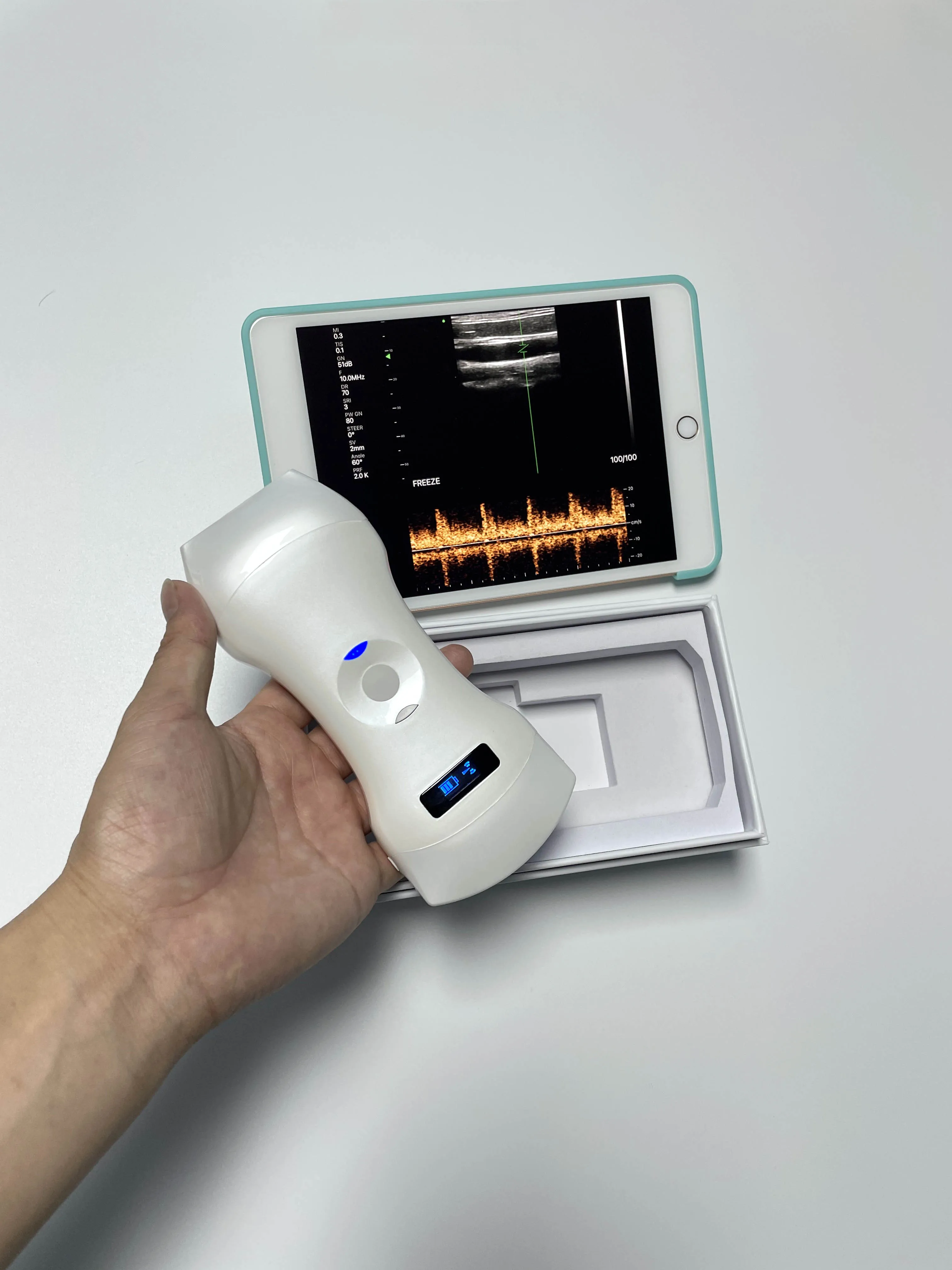 192 Element Human Scanner Instruments Handheld Device Portable Touch Wireless Ultrasound Medical Machine Equipment