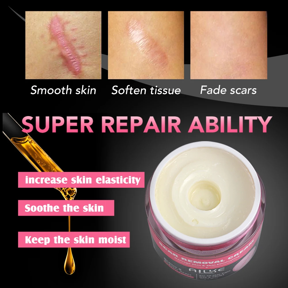 Strong Effective Acne Scar Removal Cream Smoothing Firming New Scars Stretch Marks Pimples Treatment Cream