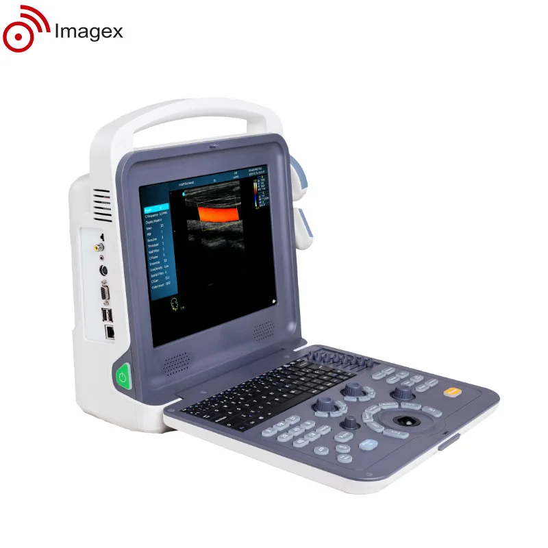 Portable Ultrasound Doppler Diagnostic System for Vascular Imaging