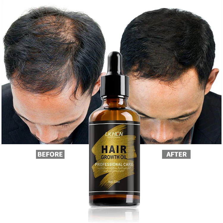 the best hair growth oil men hair oil for fast hair growth serum