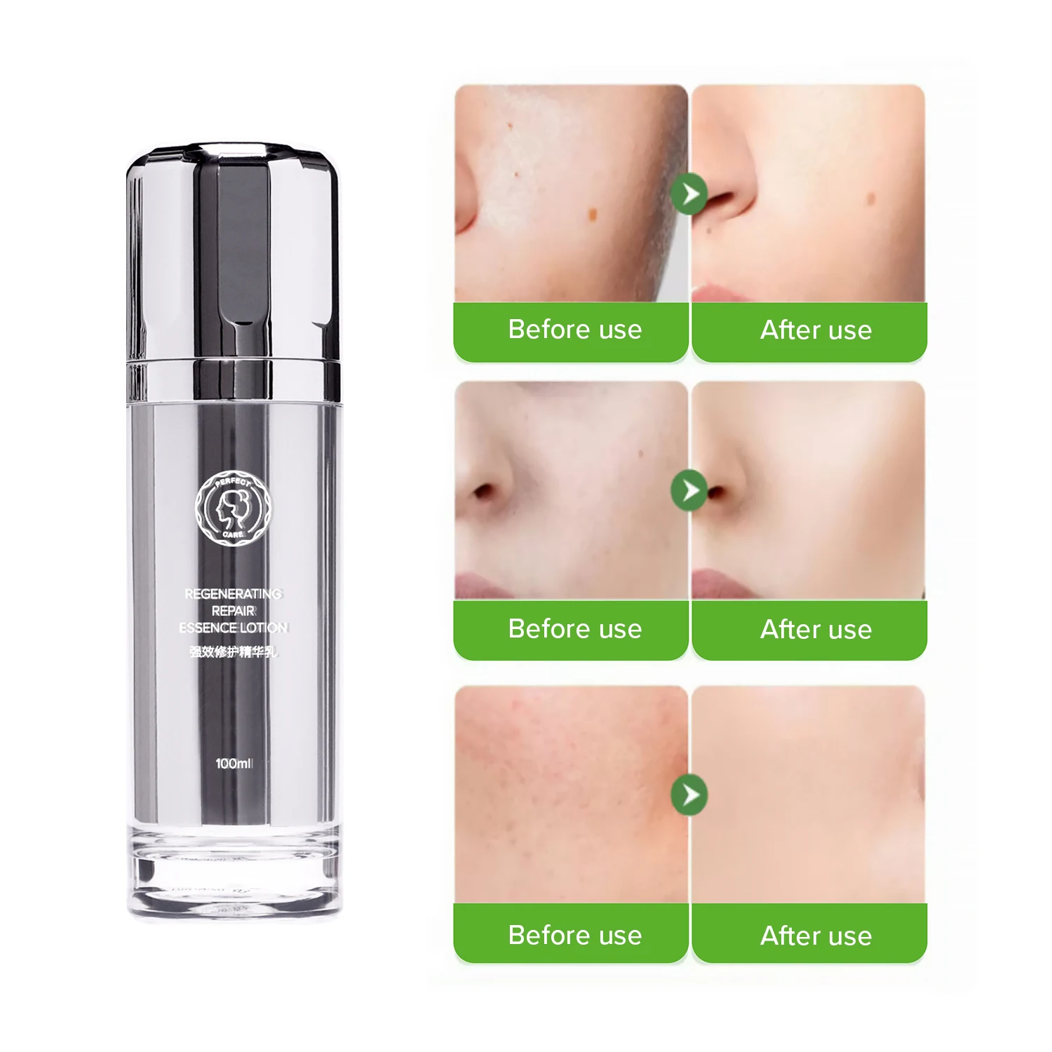 Perfectcare Centella Asiatica Anti Wrinkle Hyaluronic Acid Ginseng Azelaic Acid Rice Mucin Alpha Arbutin Serum For WomenFace