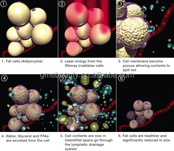 GOMECY 5 Wavelength Far Infrared 5D Lipo Laser Belt For Pain Relief And Body Contouring