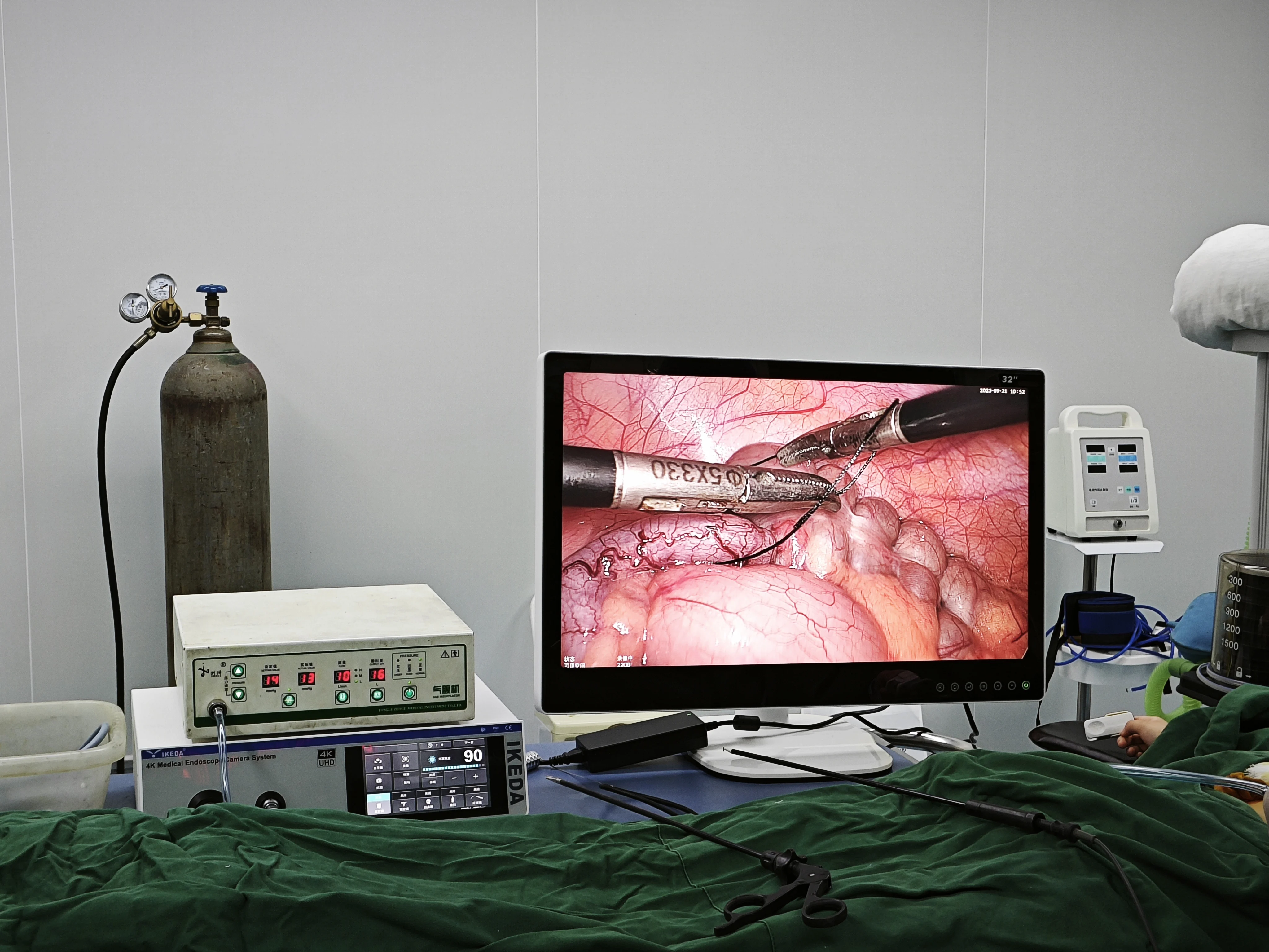 YKD-9210 High Quality 4K Endoscope Camera Medical Endoscope Camera