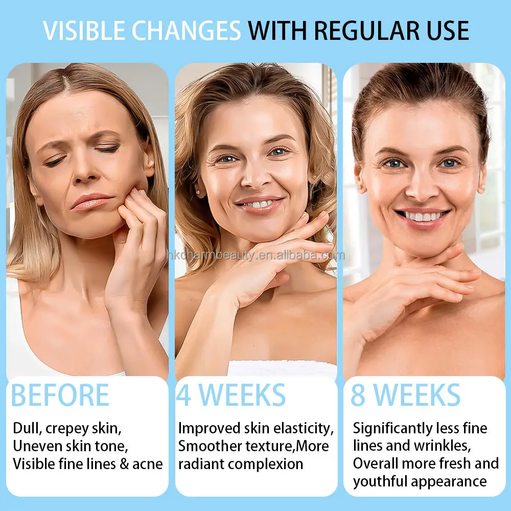 korean 5% hyaluronic acid retinol collagen anti aging face skin care whitening facial cream lotion Moisturizer for glowing skin