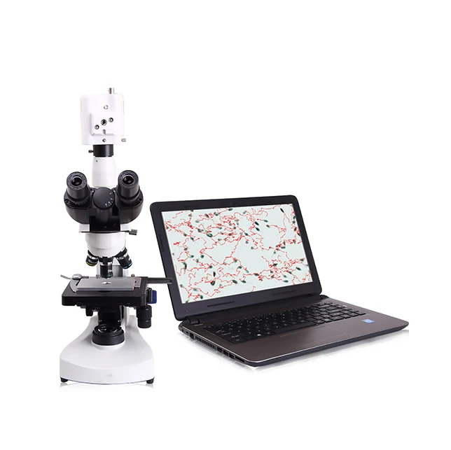 Animal sperm analyzer sperm quality analyzer