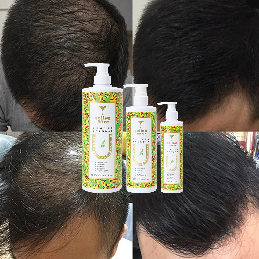 Private label anti Hair Loss Tea Tree Oil Shampoo Ginger Biotin Silicone Free Hair Growth Shampoo Rosemary Peppermint Shampoo