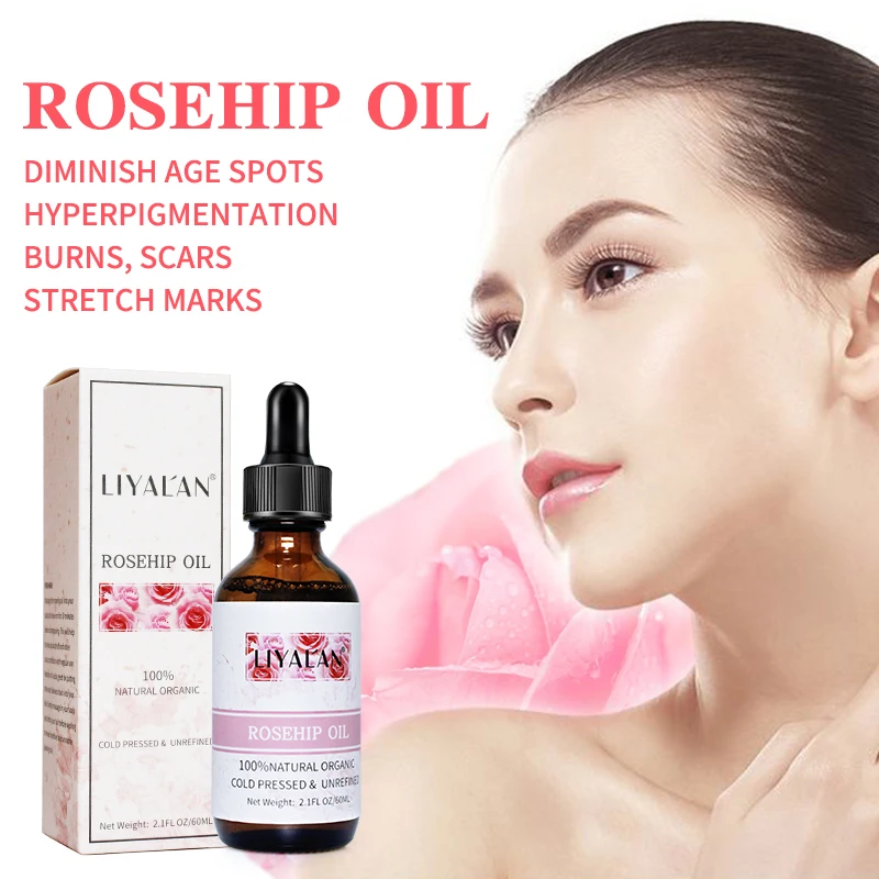 Private Label Bulk 100% Pure Cold Pressed Anti Aging Anti Scar Treatment Rosehip Oil For Face And Hair