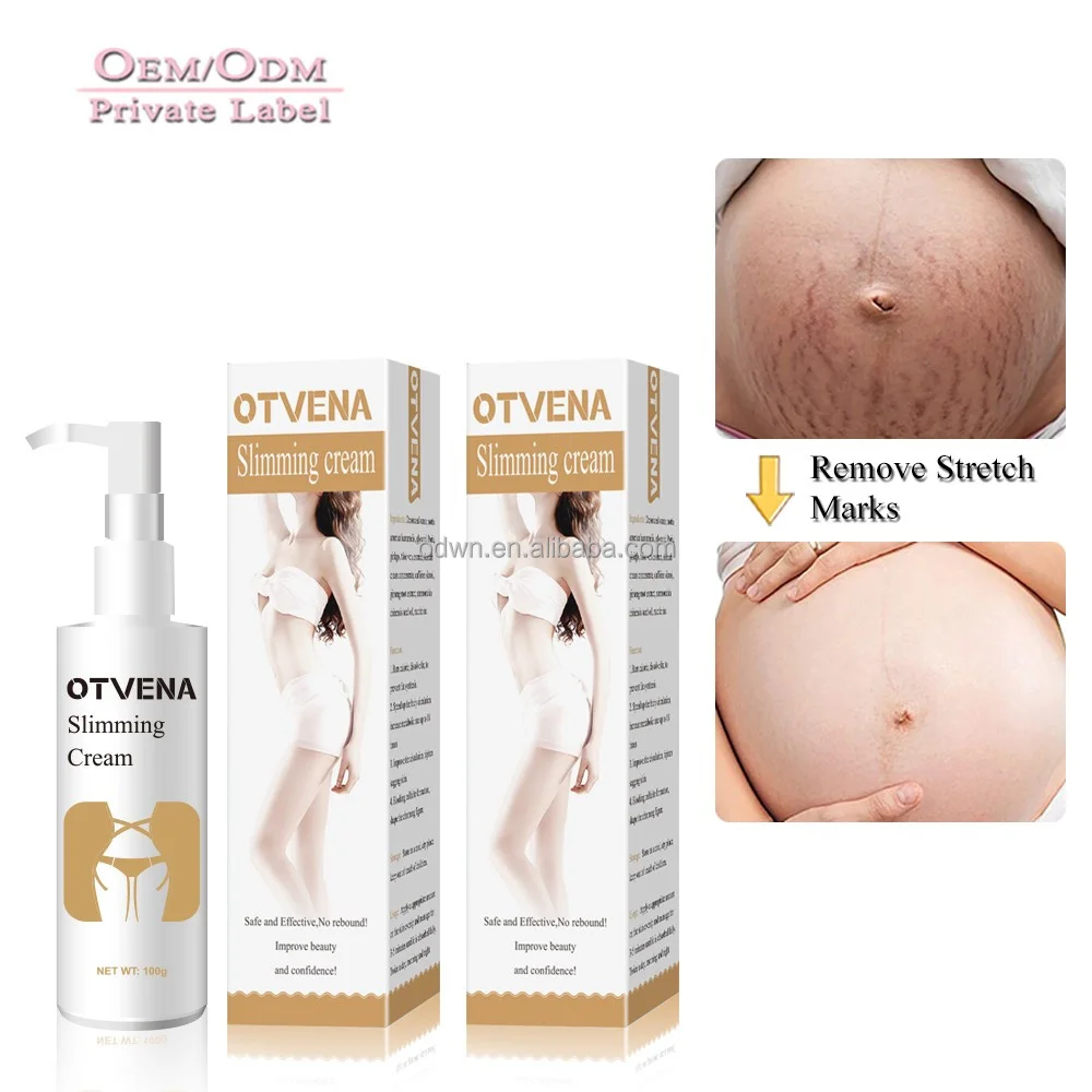 OTVENA best weight loss product Stomach slimming cream wholesale