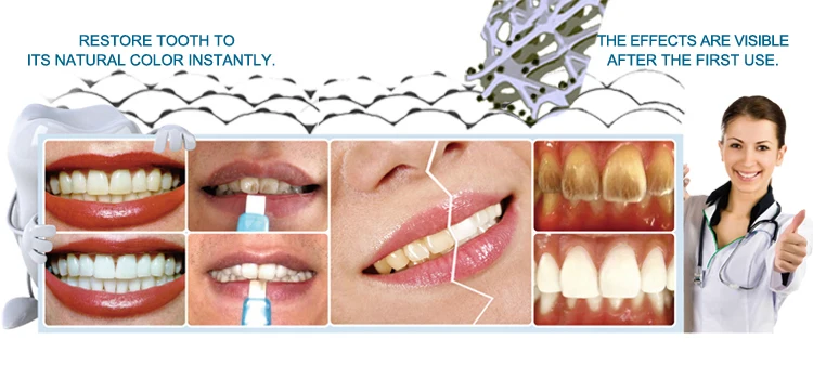 TEETH stains CLENAING kit