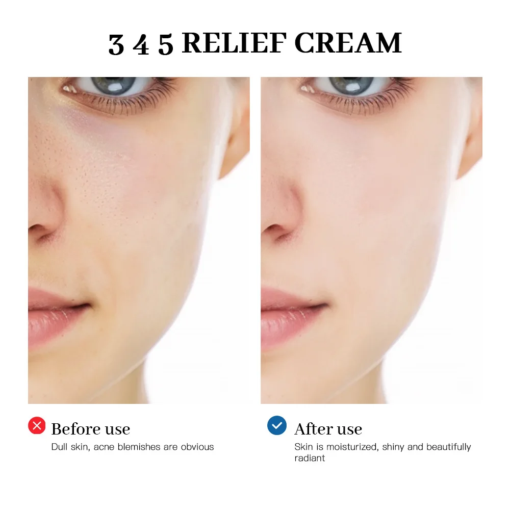 Lakerain RELIEF CREAM 50ml Concentrated care with multiple ingredients, comprehensive solution to skin problems