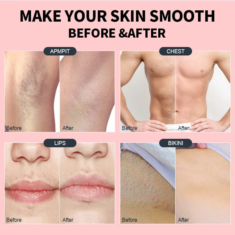 Lcorewax 2020 New Product Hair Removal Hard Wax 1kg/bag Beads Depilatory