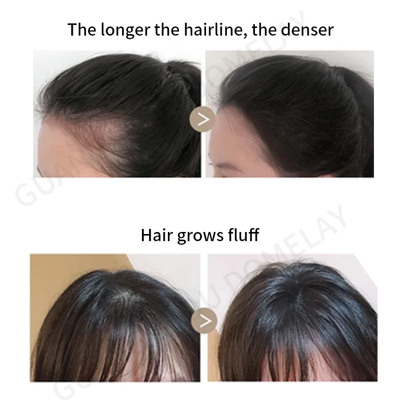 Customize Rosemary Oil Hair Growth Ginger Hair Growth Oil For Hair Treatment