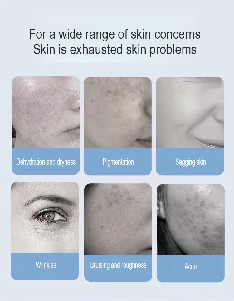 2025 Top Selling oxygen making machine portable oxygene machine hydro diamond microdermabrasion facial equipment Discount