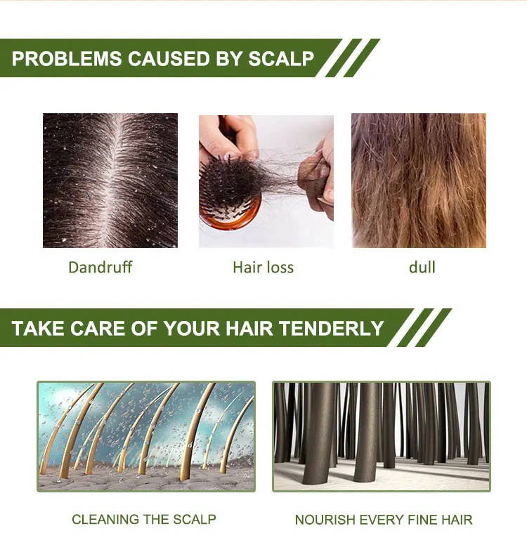 OEM Organic Anti Lice Shampoo and Conditioner Deep Cleaning Hair Nourishing Caring of Hair Eliminating Lice Shampoo