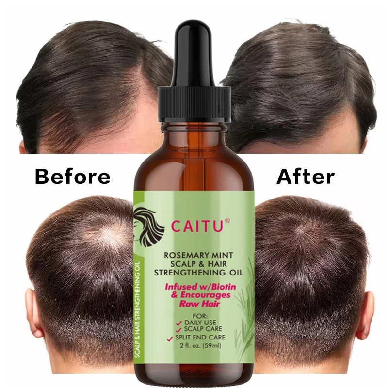 Professional Organic Rosemary Oil Nourishing Treatment Rosemary Hair Oil For Split Ends, Dry Scalp, Hair Growth