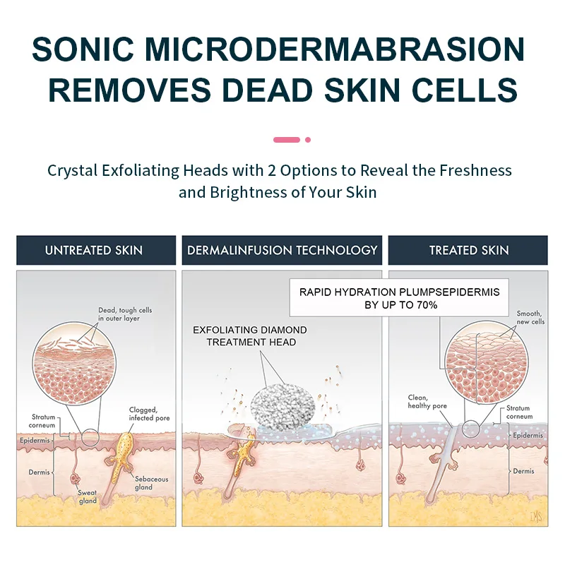 New Products OEM Private Label spring epilator ladies facial hair remover