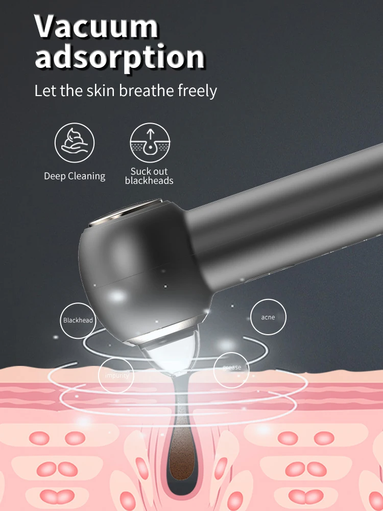 Wholesale Blackhead Remover Vacuum 4 in 1 Blackhead Remover Ultrasonic Hot Cold Intelligent Visual Nose Blackhead Remover Kit