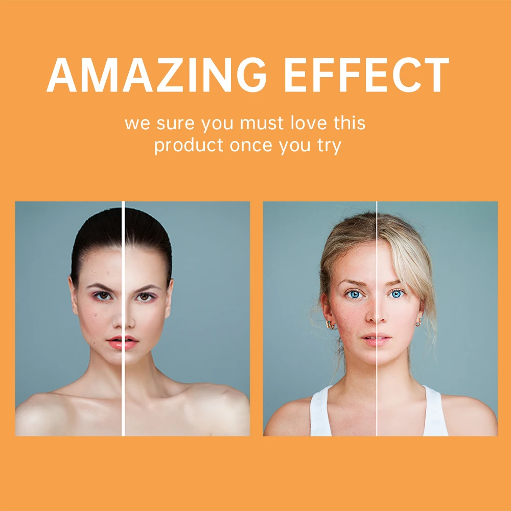 Customizing Vitamin C Face Cream Whitening Moisturizing Brightening Oem Skin Care Face Cream Set