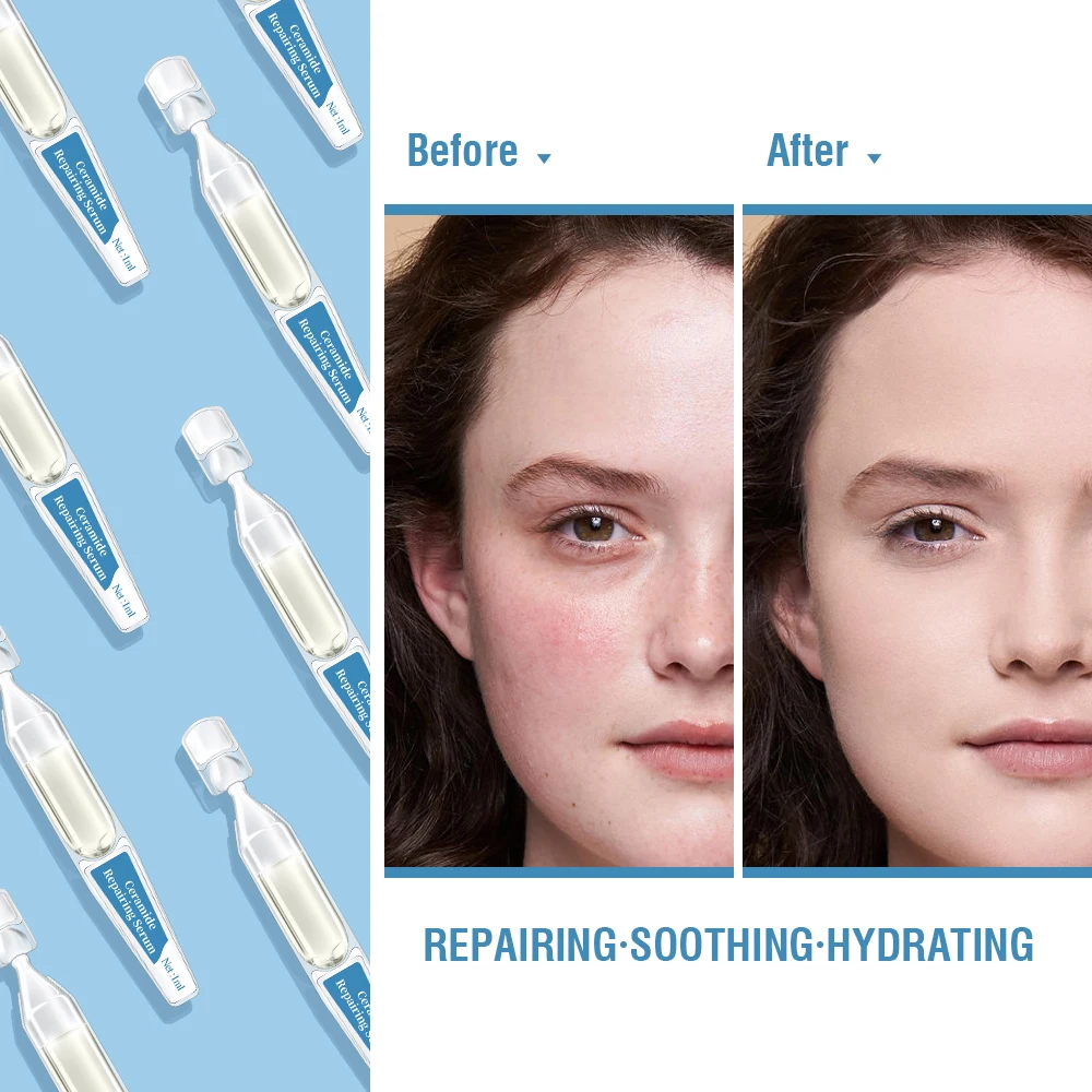 Kangrong ODM OEM Skin Care Face Care Oligopeptide-1 Sodium Hyaluronate Smoothing Hydrating Ceramide Repairing Serum