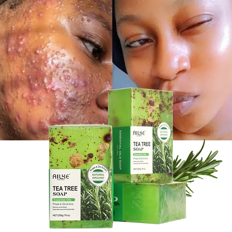 ailke Tea Tree Soap Glycerin Base Skin Lightening Face Remove Acne Body Bathing Whitening Soap