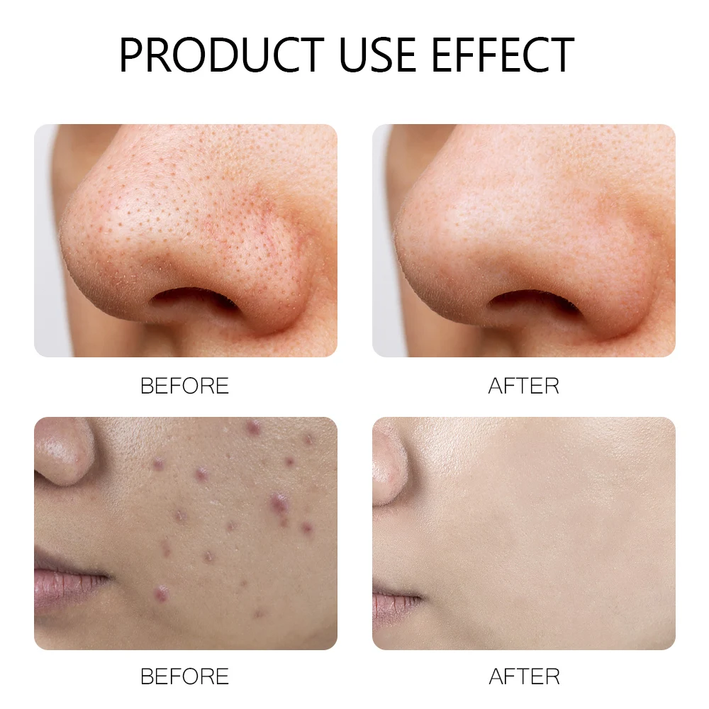 Private Label Face Skin Care Green Tea Cleansing Mask Purifying Clay Stick Facial Mud Organic Mask Stick