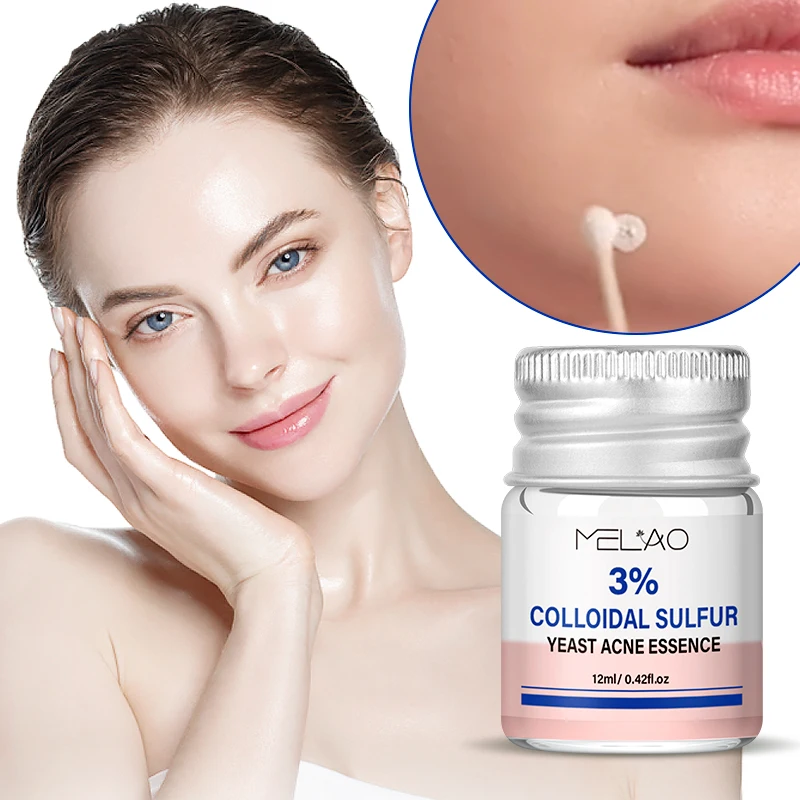 MELAO Colloidal Sulfur Yeast Acne Essence Serum OEM 12ml Niamcinamide Balancing Facial Serum For Acne Wholesale Serum