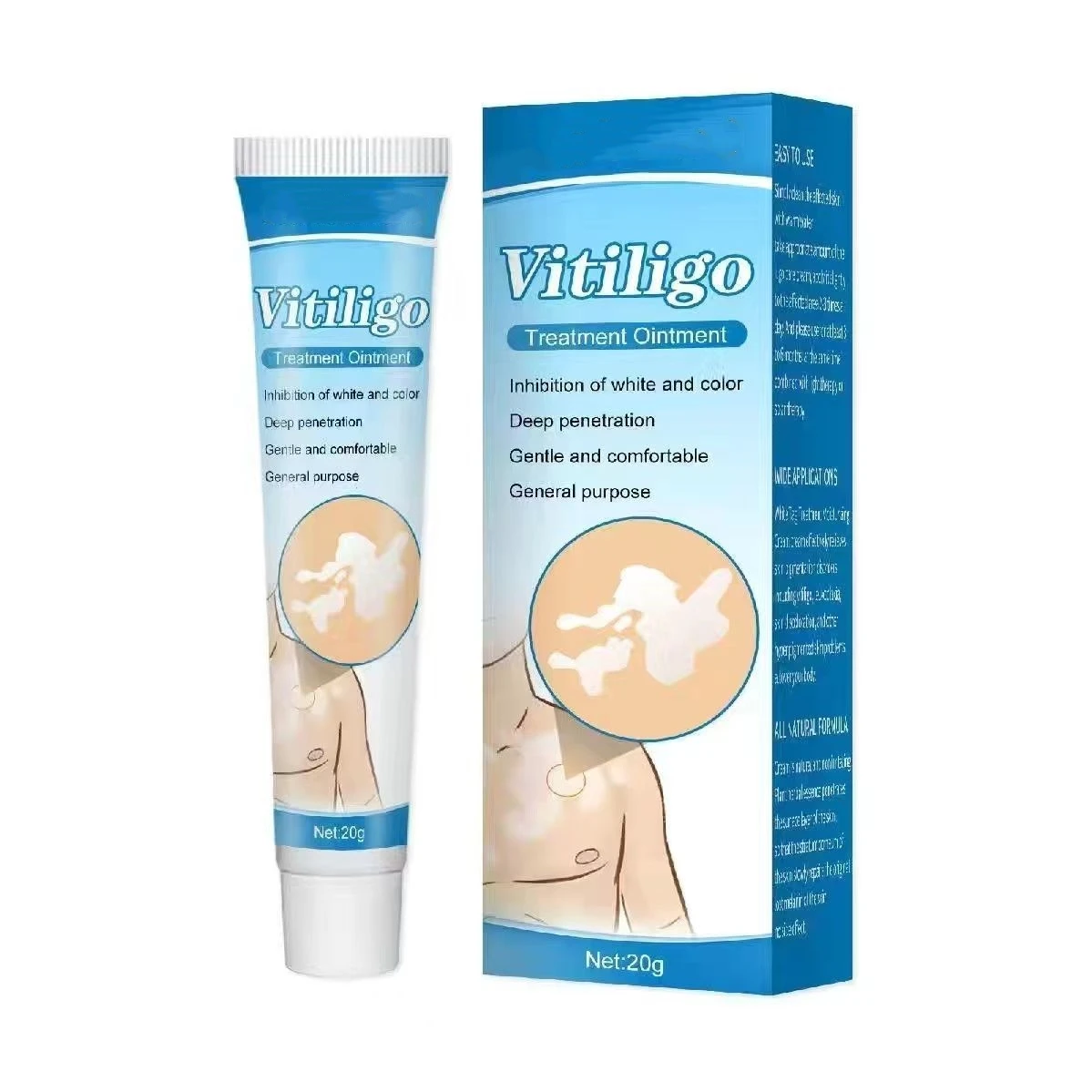 20g Herbal Extract Vitiligo Ointment Remove Ringworm White Spot Removal Skin Leukoplakia Disease Vitiligo Treatment Cream
