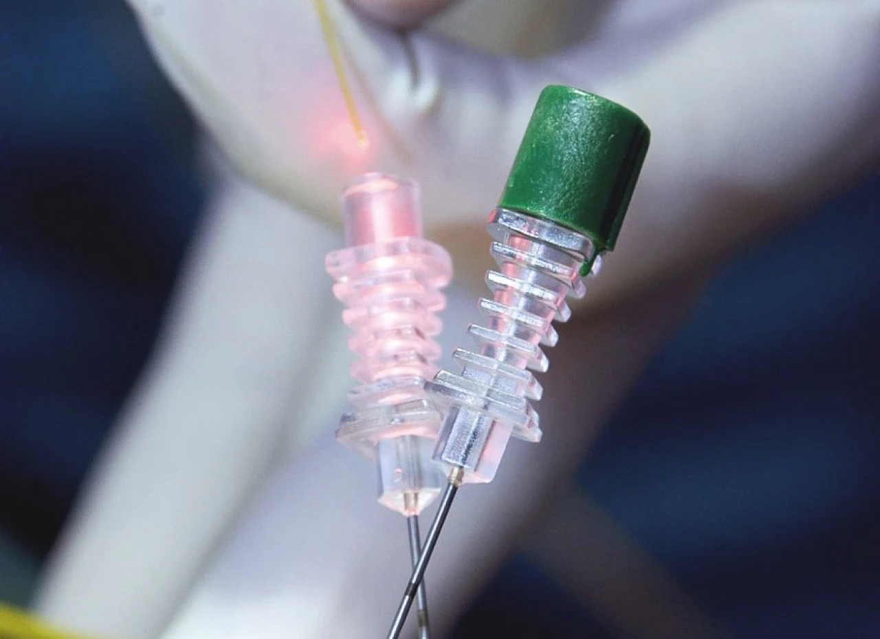 New diode surgical  pldd laser surgery equipment for numbnesssciatica laseev diode laser 980nm+1470nm