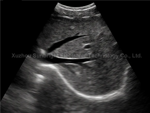 Wifi ultrasound USG wireless ultrasound probe type C connector IOS android mobile device