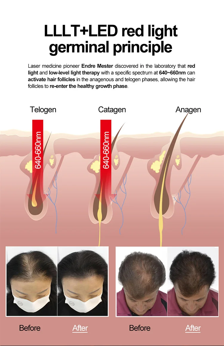 LS-601 HAIR REGROWTH (3)