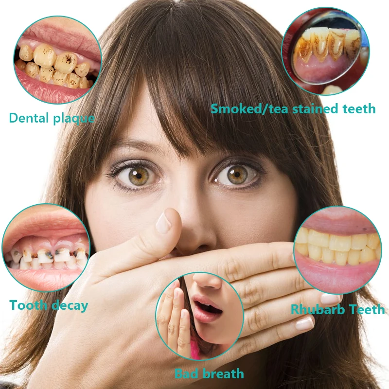 New Low Price Whiten Teeth Effectively And Fast Fast Remove Plaque Stains Bad Oral Smell Oral Teeth Care Dental